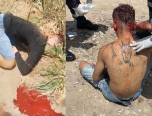 Filho do Diabo: homem é crivado de tiros na cabeça e sobrevive para mostrar tatuagem do 'Tinhoso'
