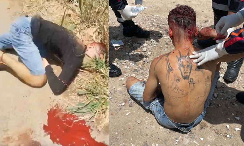 Filho do Diabo: homem é crivado de tiros na cabeça e sobrevive para mostrar tatuagem do ‘Tinhoso’; veja vídeo