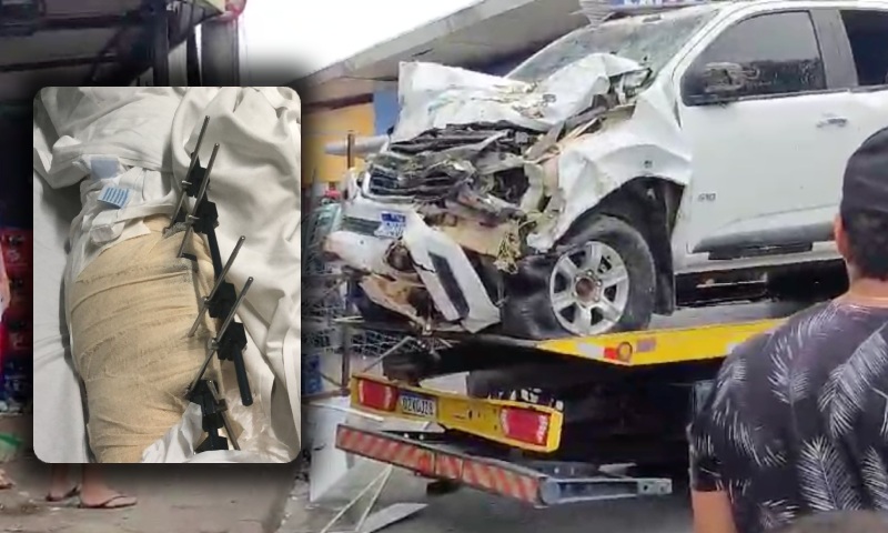 Funcionário do Buteco de Ponta que teve as pern4s quebrad4s por carro em Manaus se recupera de cirurgia; veja vídeo