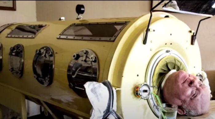 Homem que viveu em “pulmão de ferro” m0rre de Covid-19 aos 78 anos