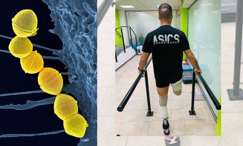 Cidade do Japão está em estado de alerta após surto de bactéria “carnívora” que mata 30% dos infectados