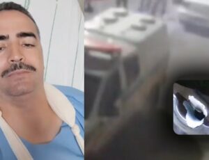 CENAS F0RTES: "esse é o estado do meu braço", mostra sargento bale4do por ladrões de carro; veja vídeo