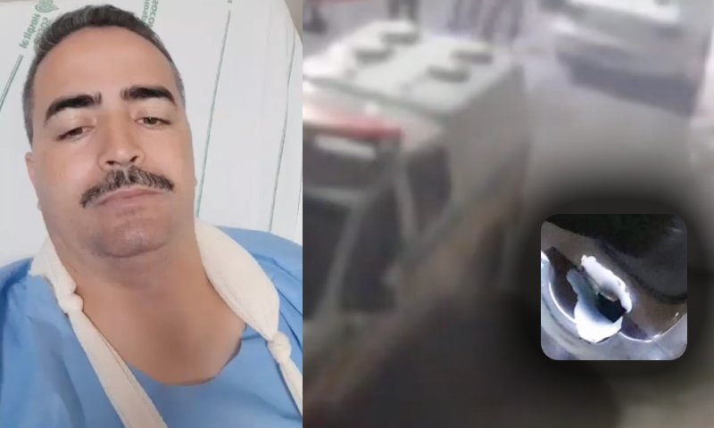 CENAS F0RTES: “esse é o estado do meu braço”, mostra sargento bale4do por ladrões de carro; veja vídeo