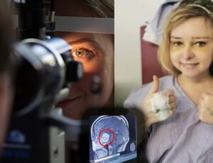 Exame de vista salva mulher que não sabia que tinha tumor no cérebro