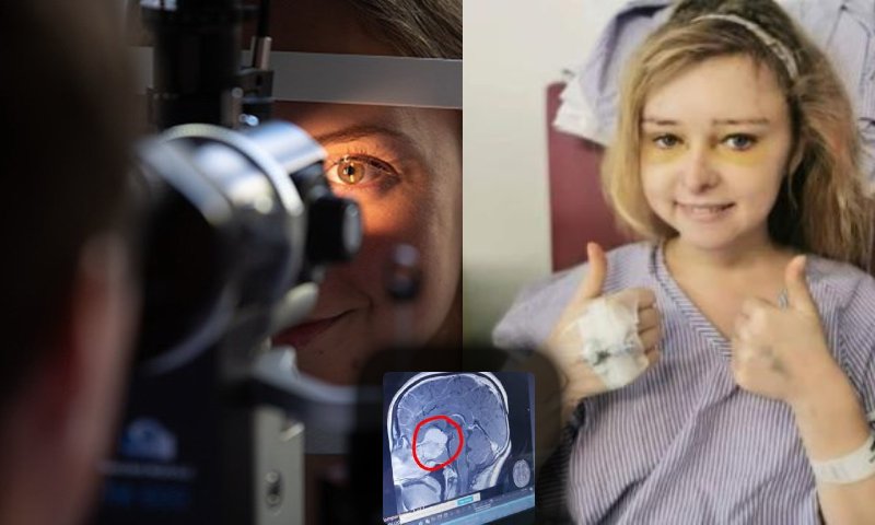 Exame de vista salva mulher que não sabia que tinha tumor no cérebro