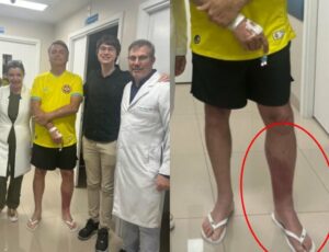 Saiba o que é Erisipela, infecção que afeta a perna de Jair Bolsonaro; veja