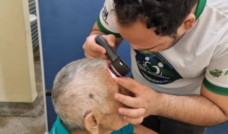 SES-AM adverte população sobre a importância da prevenção e conscientização sobre o câncer de pele