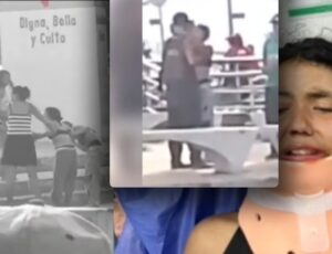 Linda jovem termina com f4cão cr4vado no rosto por causa do namorado "zé droguinha"; veja vídeo