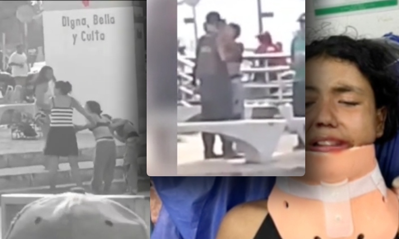 Linda jovem termina com f4cão cr4vado no rosto por causa do namorado “zé droguinha”; veja vídeo