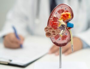Estudo da Hapvida NotreDame Intermédica indica que cerca de 4% dos beneficiários adultos têm algum grau de doença renal crônica