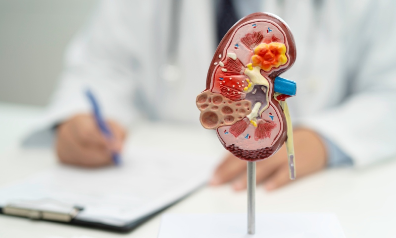 Estudo da Hapvida NotreDame Intermédica indica que cerca de 4% dos adultos têm algum grau de doença renal crônica