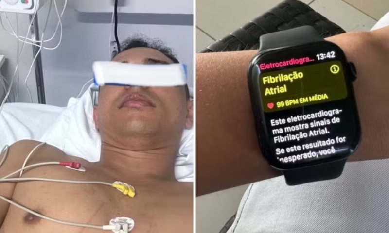 Homem descobre princípio de parada cardíaca após alerta em relógio inteligente: ‘Renasci’