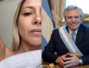 Ex-primeira-dama da Argentina mostra hemat0mas após agr3ssões sofridas por Alberto Fernández; veja