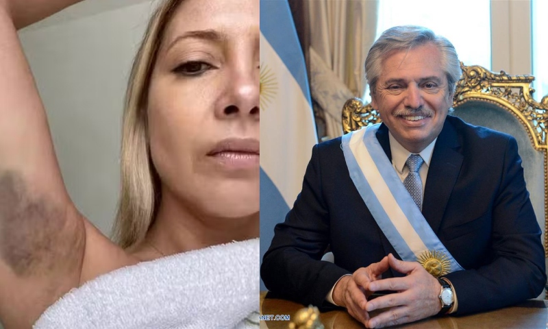 Ex-primeira-dama da Argentina mostra hemat0mas após agr3ssões sofridas por Alberto Fernández; veja
