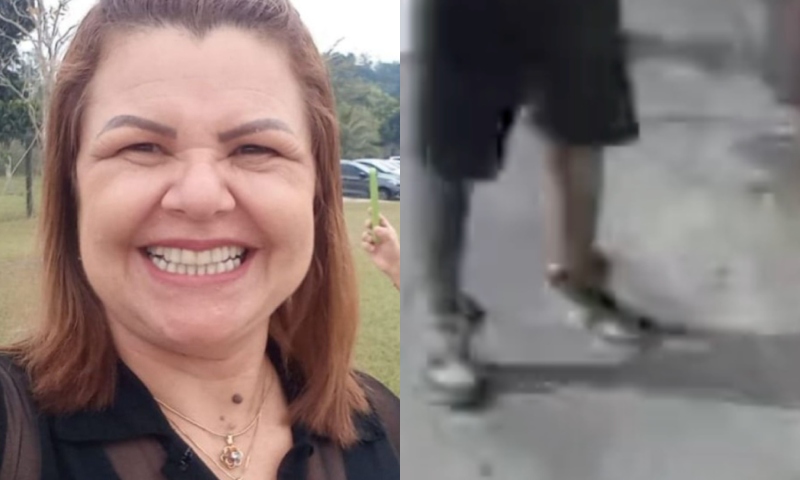 Mulher que teve p3rna arr4ncada durante ac1dente na Compensa m0rre em hospital