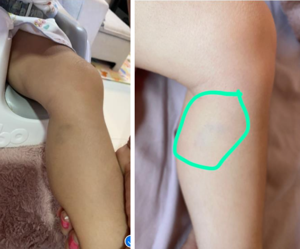 Escândalo: médico acusado de b4ter na filha invade condomínio para at4car a ex em Manaus; veja vídeo