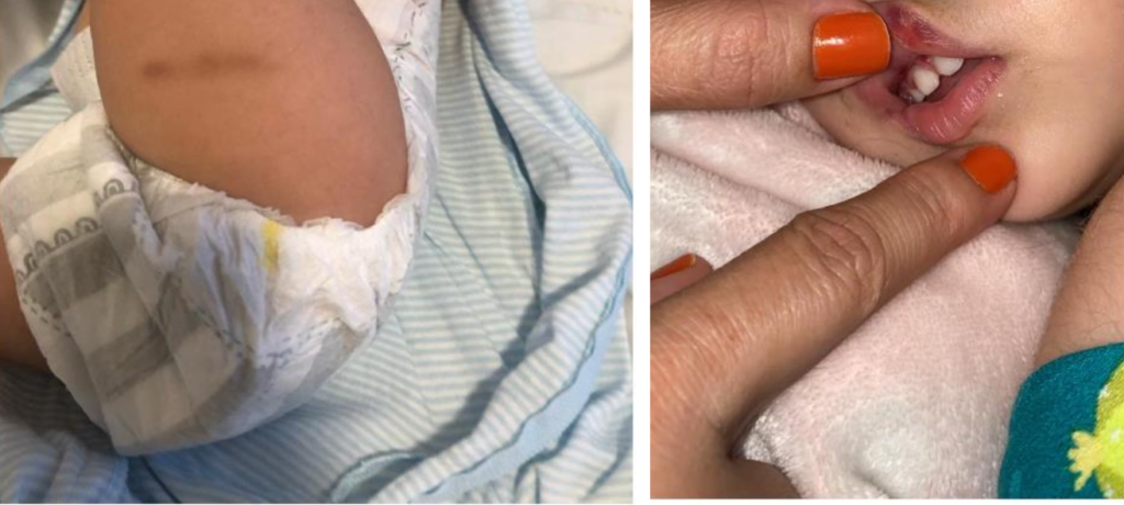 Escândalo: médico acusado de b4ter na filha invade condomínio para at4car a ex em Manaus; veja vídeo