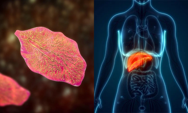 Bizarro: “Verme do Fígado” é encontrado em homem que reclamava de cansaço e anemia; veja vídeo