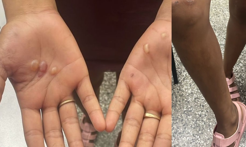 “Ela era como uma mãe pra mim”, diz menina de 12 anos torturada por amiga da família em Manaus; veja vídeo