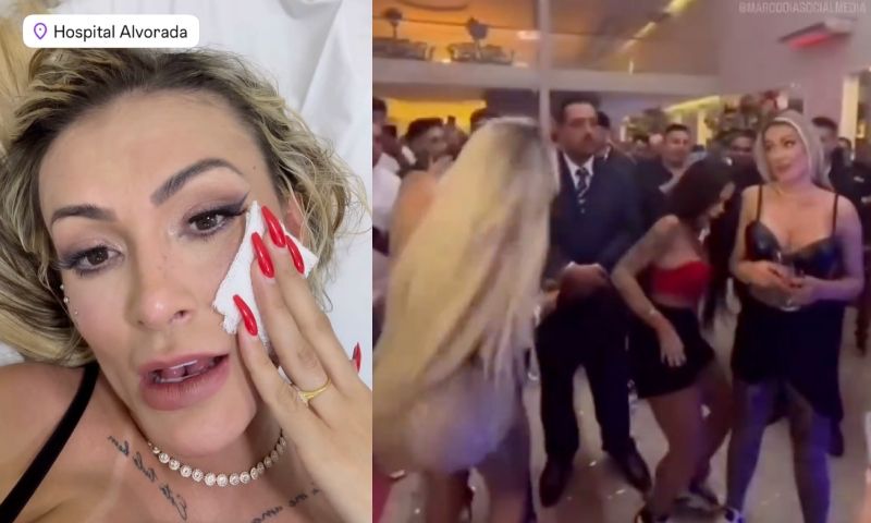 Andressa Urach leva pontos no rosto após sair na porrada com Juju Ferrari em festa; veja vídeos