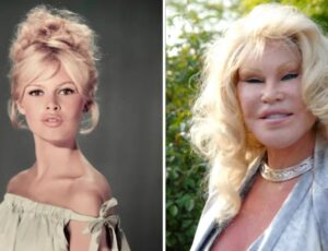 Morre Jocelyn Wildenstein, socialite conhecida como a 'Mulher Felina'
