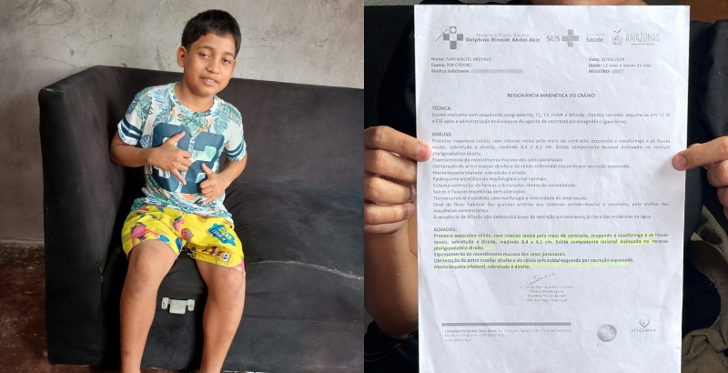 Infância Interrompida: menino de 12 anos enfrenta câncer e luta pela sua sobrevivência em Manaus