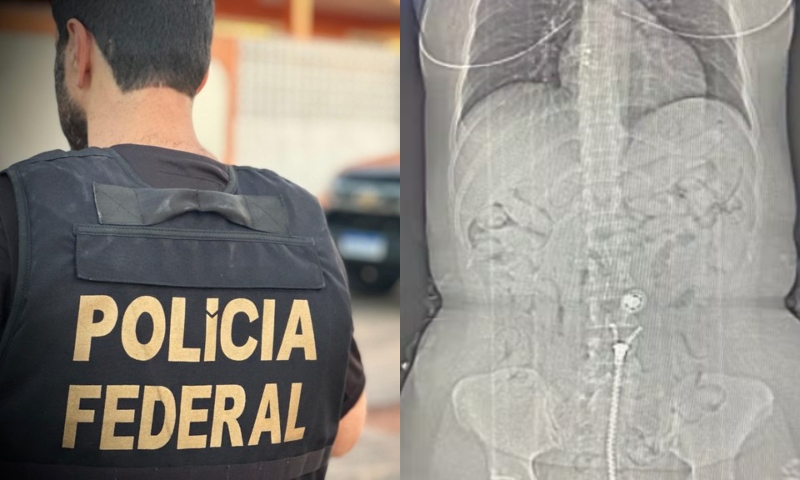 Mulheres que saíram de Manaus são presas com cocaína no estômago em voo para a Europa