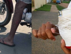 Combinação perigosa: homem descobre da pior forma porque não se deve pilotar moto de chinelo; veja