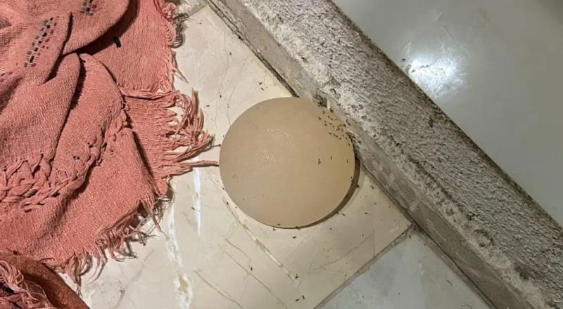 Ciúme doentio: mulher tem silicone arrancado na faca pelo próprio marido; veja