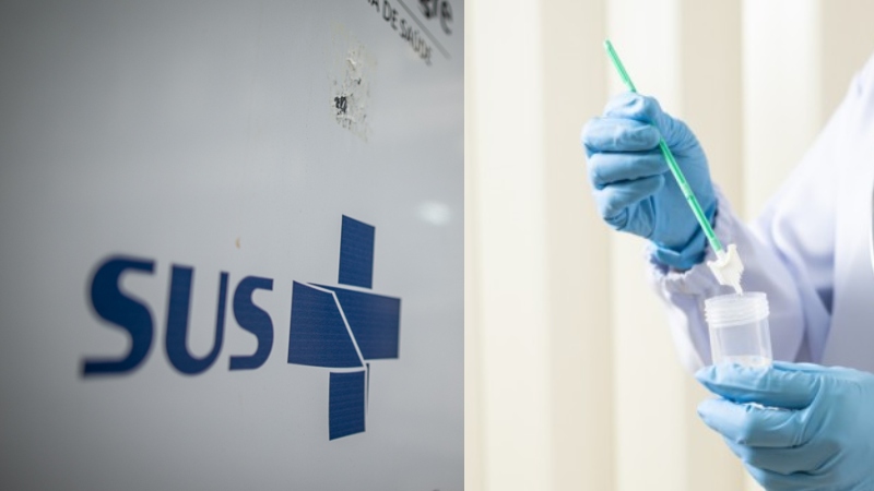 SUS vai substituir papanicolau por teste de DNA a partir de maio