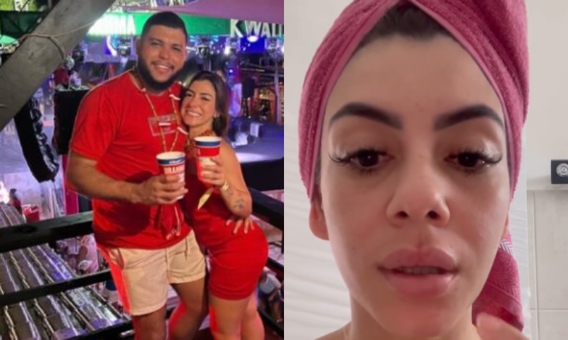 Ex-esposa que foi espancada pelo cantor Diego Damasceno revela que descobriu ‘corpo estranho’ nos lábios