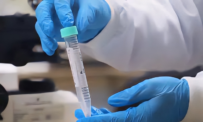 FVS-RCP registra redução de casos de mpox no Amazonas