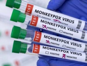 Amazonas e Pará já somam mais de 50 casos de Mpox em 2025