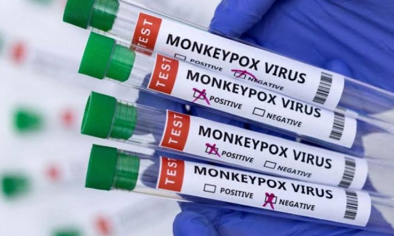 Amazonas e Pará já somam mais de 50 casos de Mpox em 2025