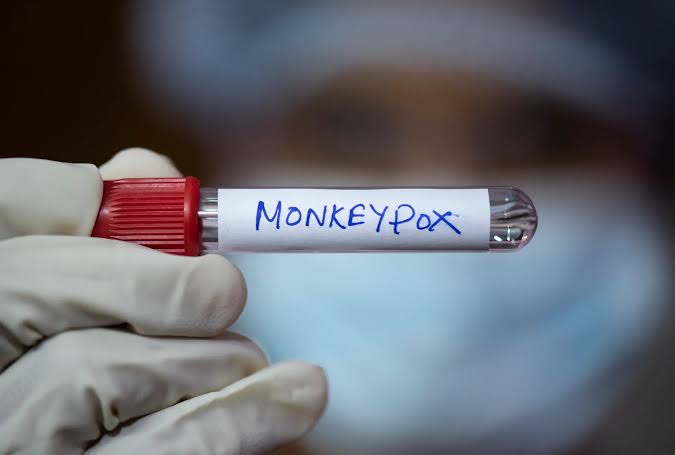 Amazonas registra mais de 33 casos de Mpox em 2025