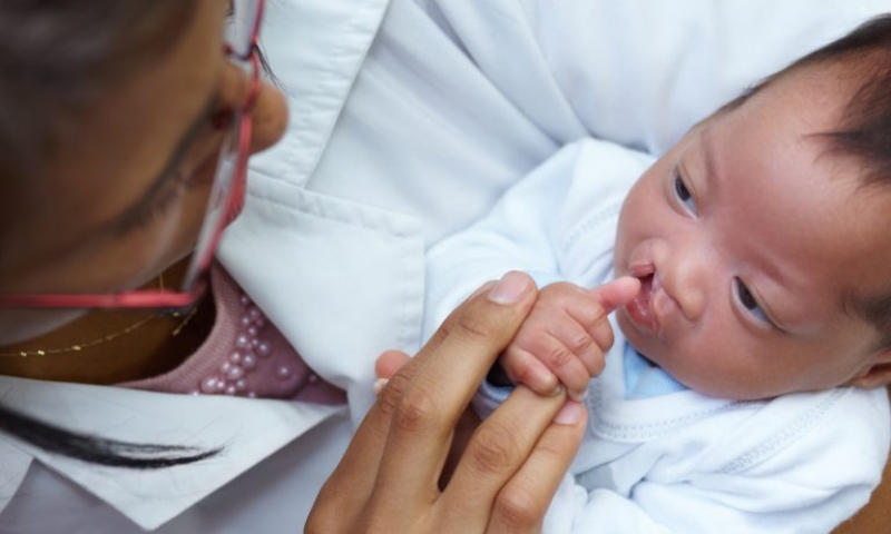 Nova lei obriga SUS a ofertar cirurgia de lábio leporino