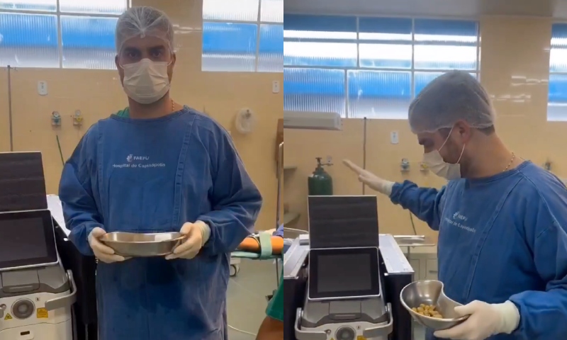 Chocante: médico retira 35 pedras dos rins de paciente viciado em refrigerante; veja vídeo
