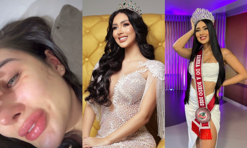 Urgente: Miss Grand Amazonas 2024, Mariana Barroso, revela que foi espancada e ameaçada de morte pelo ex; veja vídeo
