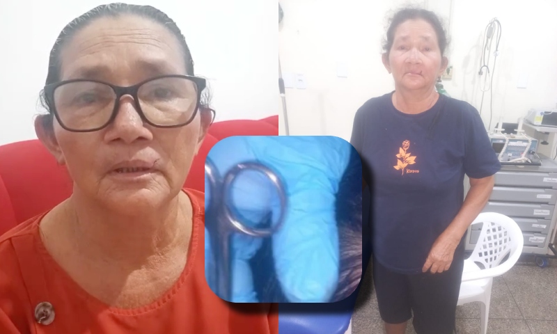 Revoltante: idosa é espancada durante tentativa de estupro no Amazonas e suspeito continua solto; veja vídeo