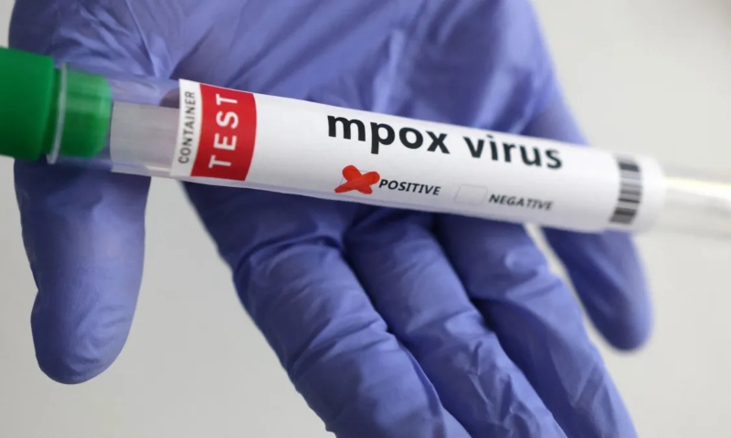 Amazonas registra 38 casos de Mpox, sendo um deles em Parintins às vésperas do Festival