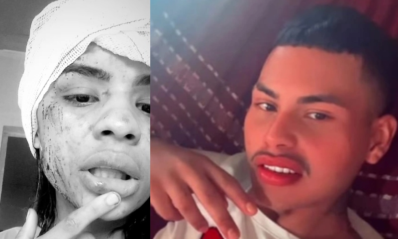 Mulher é espancada e tem rosto desfigurado após rejeitar ficar com jovem em festa de Manaus; veja vídeo