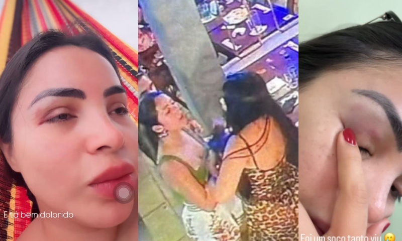 Blogueira Sandy Brasil leva murro no olho durante bebedeira e revela: “Só porque sou gostosa”; veja vídeo