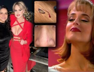 Ex-assessora diz que Gabriela Spanic a agrediu por expor bebedeira: "Me bateu e tirou meus óculos"