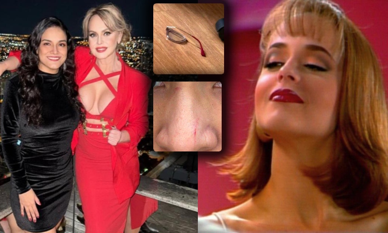 Ex-assessora diz que Gabriela Spanic a agrediu por expor bebedeira: “Me bateu e quebrou meus óculos”