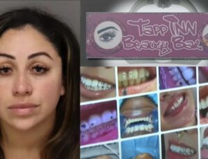 Falsa dentista é presa na Flórida após usar cola de unha em facetas de clientes; veja vídeo