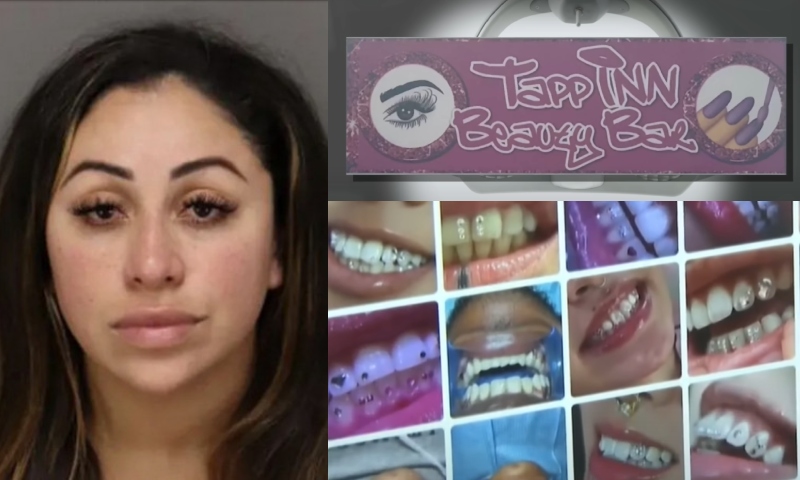 Falsa dentista é presa na Flórida após usar cola de unha em facetas de clientes; veja vídeo