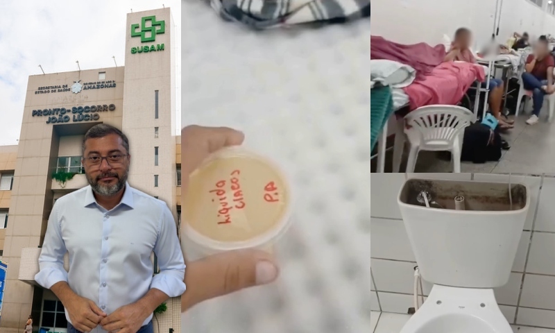 Pacientes nos corredores, banheiros quebrados e ‘sopa’ de óleo e sal: gestão de Wilson Lima abandona o hospital João Lúcio; veja vídeo