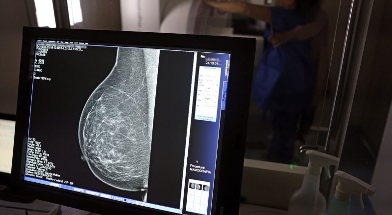 Outubro Rosa: mulheres do Norte ainda têm o menor acesso à mamografia, revela relatório de 2025