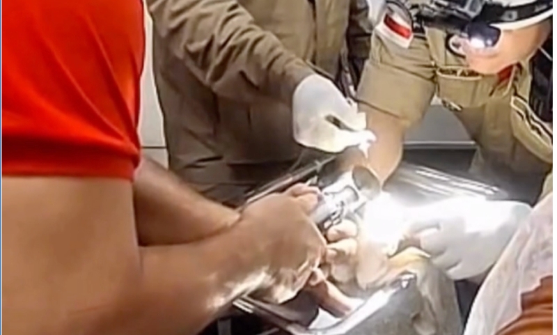 Criança é resgatada após prender dedo em portão no bairro Riacho Doce 2; veja vídeo