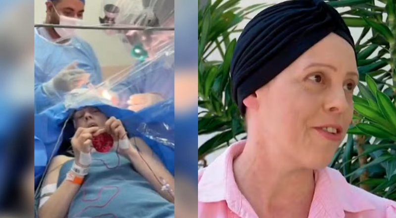 Vídeo mostra paciente acordada fazendo crochê enquanto médicos retiram tumor do cérebro dela; veja